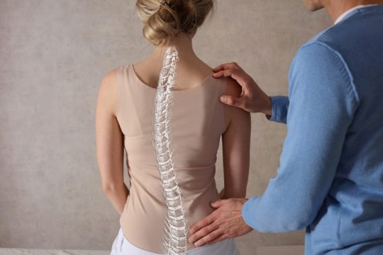 Fisioterapeuta a tratar escoliose nas costas de uma mulher